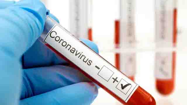 lustrasi virus corona covid-19/photo copyright by Shutterstock
